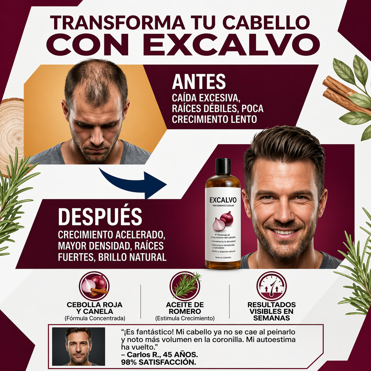 Shampoo Excalvo - Reduce la Pérdida y Estimula el Crecimiento